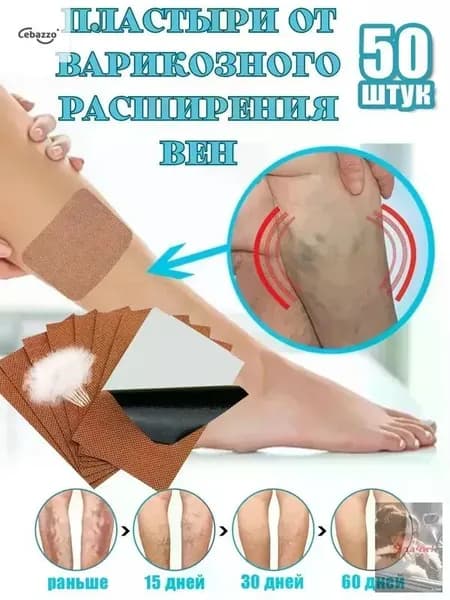 Пластыри от варикозного расширения вен и васкулита / От венозной недостаточности / Обезболивающий Китай