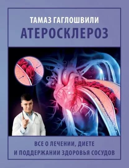 Атеросклероз. Все о лечении, диете и поддержании здоровья сосудов | Гаглошвили Тамаз Тамазович | Электронная книга