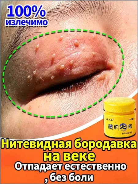 Крем-гель от мелких наростов, нитевидных бородавок и папиллом на веках