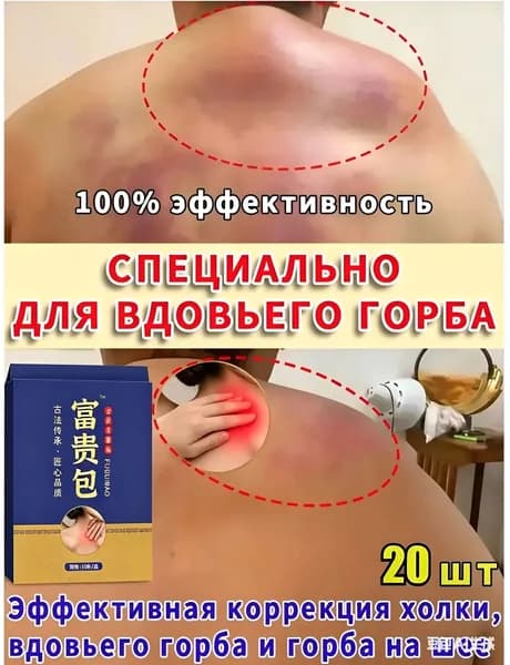 Пластыри для ухода за шеей: от холки, горба и жировых образований. Набор 2 уп. х 10 шт. Снятие дискомфорта, поддержка мышц. Выгодный курс для здоровья спины.