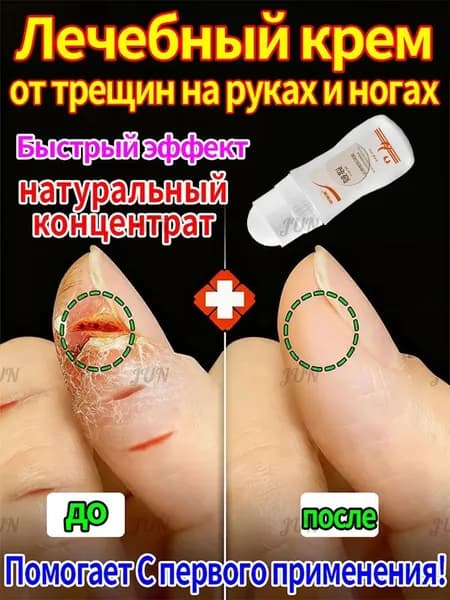 Крем для рук и ног против сухости и трещин