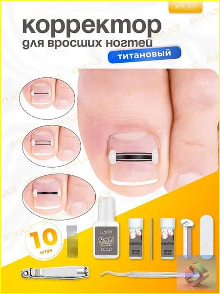 Премиальный набор корректоров для терапии вросших ногтей