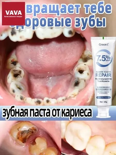 зубная паста 7,5% гидроксиапатита восстановление эмали предотвращение кариеса