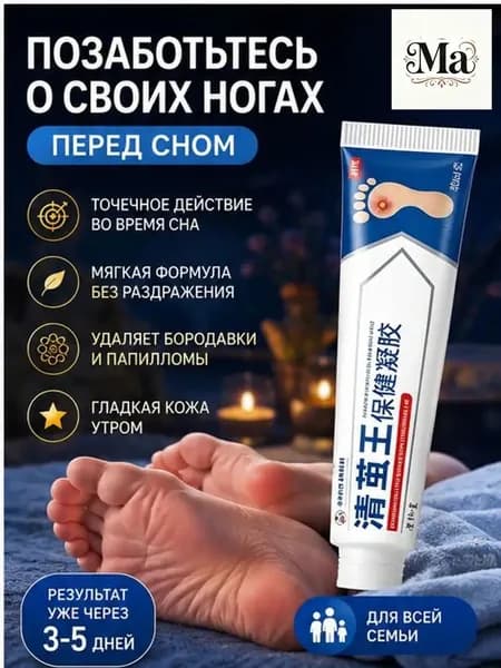 Мазь и гель Корнекс 20 г, используемые для удаления сухих стержневых мозолей, натоптышей и шипиц, являются качественным китайским средством