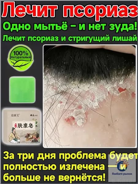 Успокаивающее мыло от зуда шелушения и псориаза волосистой части головы
