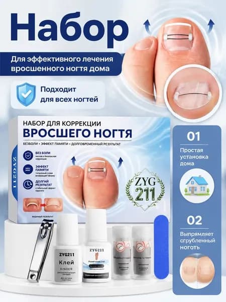 Bросших ногтей Комплект из 30 никелид-титановых корректоров для вросших ногтей
