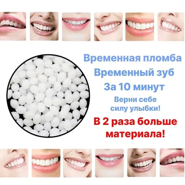 Декоративная временная пломба для зуба. Виниры для зубов накладные верхние и нижние силиконовые. Виниры. Брекеты. Материал пломбировочный временный (Кольтасол).