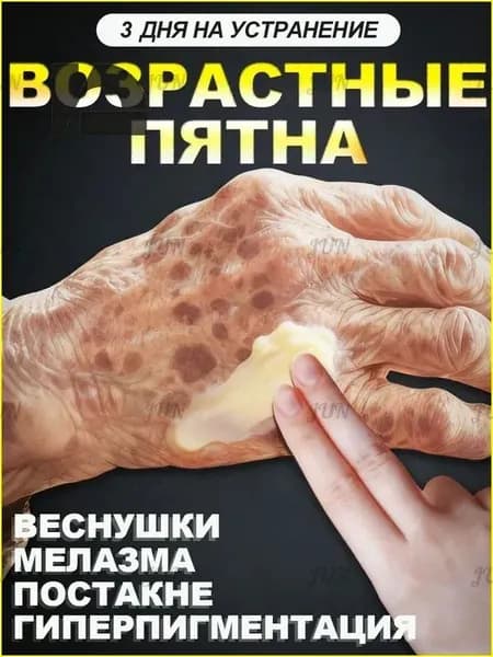 ретидерм крем для лица антивозрастной,Крем для удаления веснушек и отбеливания способен удалить веснушки,хлоазму,солнечные пятна,пигментные пятна, Содержит гиалуроновую кислоту и 377.