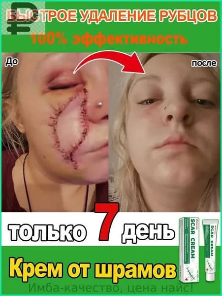 Крем для удаления шрамов. Быстро удаляет шрамы, растяжки, следы от акне и ожогов. Мягкий и не раздражающий, подходит как мужчинам, так и женщинам. 20 мл