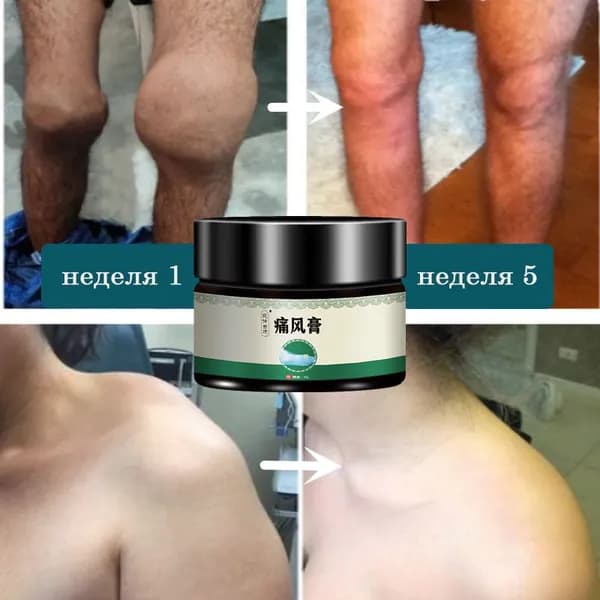 Крем Gout Pain Relief Cream 35 гм для лечения подагры, артрита и вальгусной деформации, помогает снять отек и уменьшить мышечное напряжение.