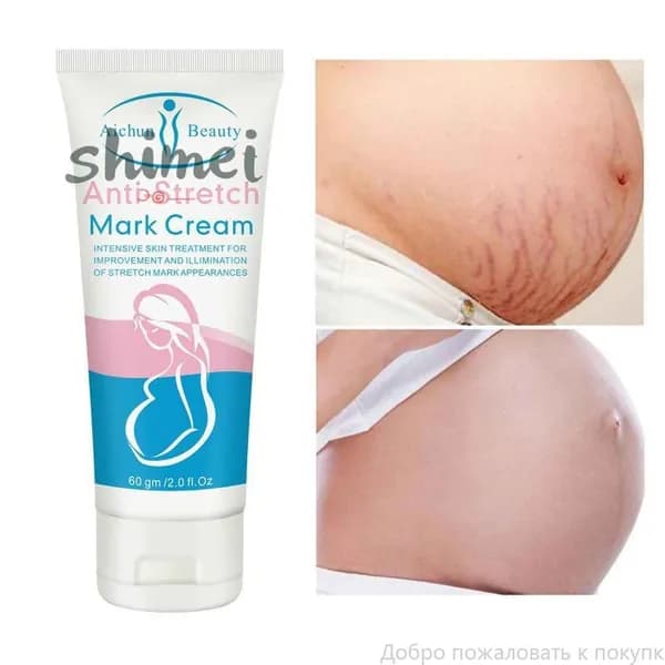Anti-Stretch Mark Cream укрепляющий , крем укрепляющий от растяжек для беременных, 60 г