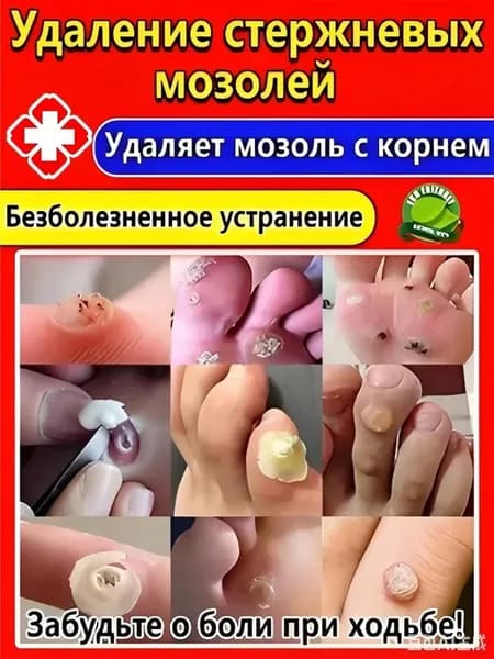 средство от стержневых мозолей на ногах