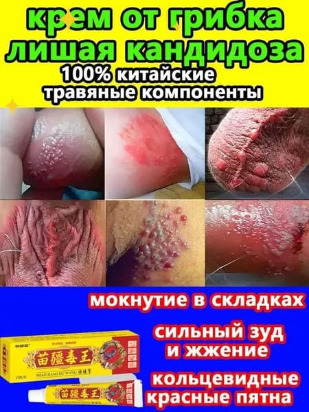 Китайский травяной крем Miao Jiang Du Wang для ухода за проблемной кожей, 1 туба, мягко снимает зуд и дискомфорт при раздражениях кожных покровов