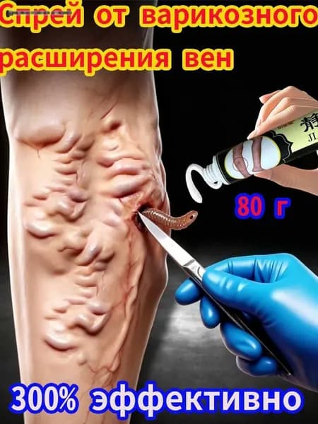 от варикоза, подходит для лечения отеков и тяжести в ногах, сосудистой сеточки, тромбов, 80 г