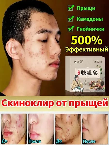 Твердое мыло