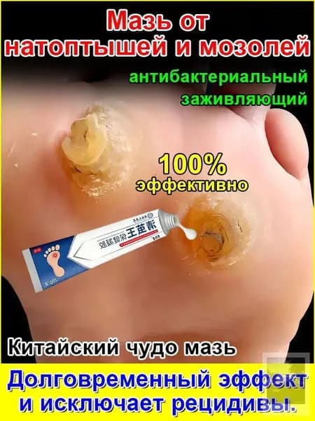 Крем от сухих мозолей и натоптышей. Мозольный бальзам для пяток, пилинг для ног. 16