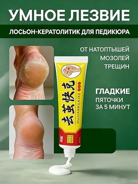 Средство от мозолей и натоптышей на ногах / Мазь от бородавок и папиллом на руках и лице