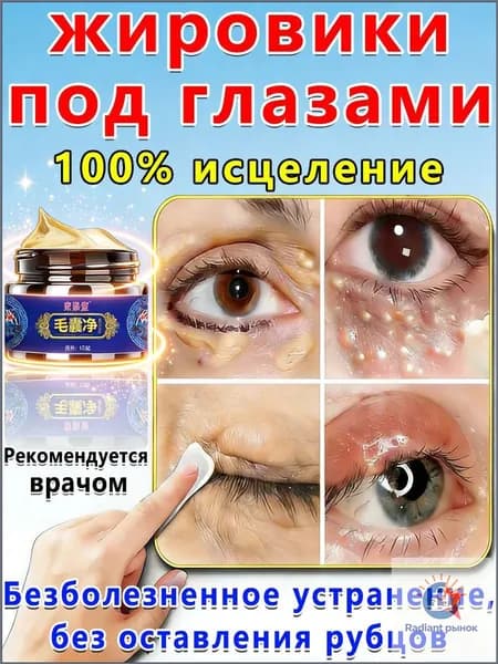 Мазь от жировики под глазами Милиумы Просянка, 30 r