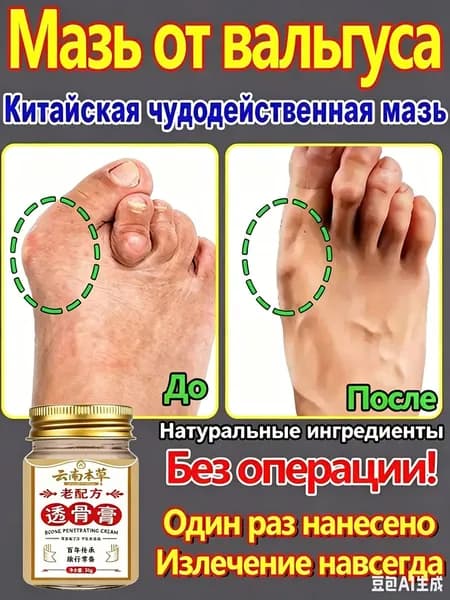Крем при вальгусной деформации, от шишек на больших пальцах ног, Боль в суставах, подагра20 г