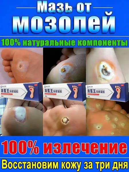 Крем удаляет натоптыши, бородавки, шипы и осколки на пятках