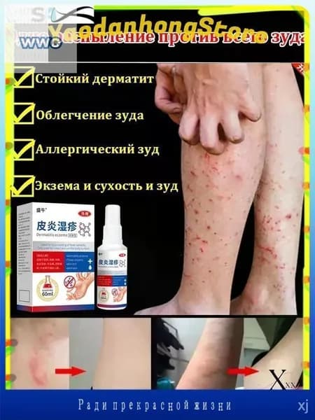 Эксклюзивный спрей 60 мл для снятия зуда при дерматите, герпесе, экземе и грибковых поражениях кожи