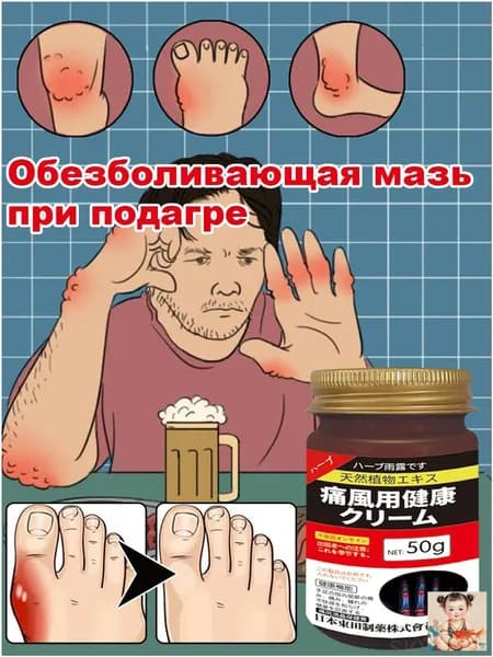 Обезболивающая мазь при подагре, Устранение кристаллических отложений при подагре, 50 г