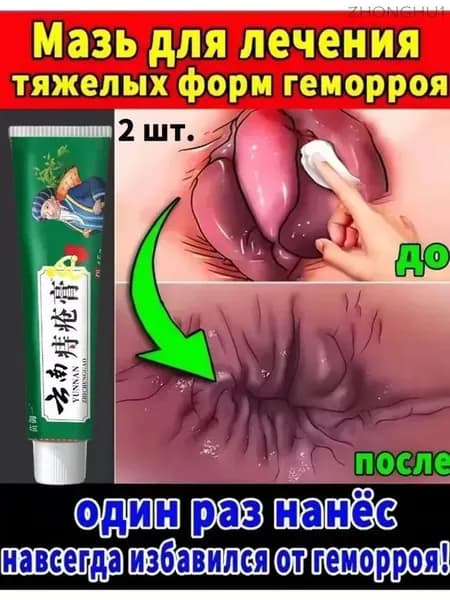 Чудодейственный восстанавливающий крем для устранения геморроя и опухолей, способствующий заживлению анальных трещин и устранению зуда;/2 шт.