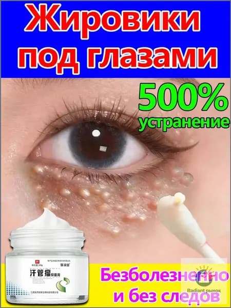 Удаление милиумов под глазами и на веках Быстрое избавление от жировых гранул. Мазь/крем для лечения