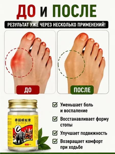 Мазь при вальгусной деформации косточки обезболивающая 55 г