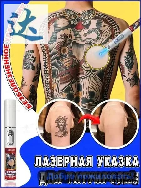 Ручка для лазерного удаления татуировок, перманентное удаление татуировок, безболезненное, без побочных эффектов, без шрамов, 1 ручка