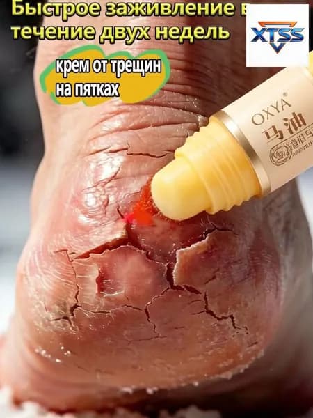 Кремвоск премиум с 5 мочевиной, предназначенный для регенерации очень сухой кожи и устранения трещин на пятках, используется для ног.