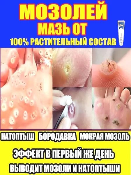 - Средство от натоптышей и бородавок смягчает мозоли, удаляет шипицы, натуральный состав