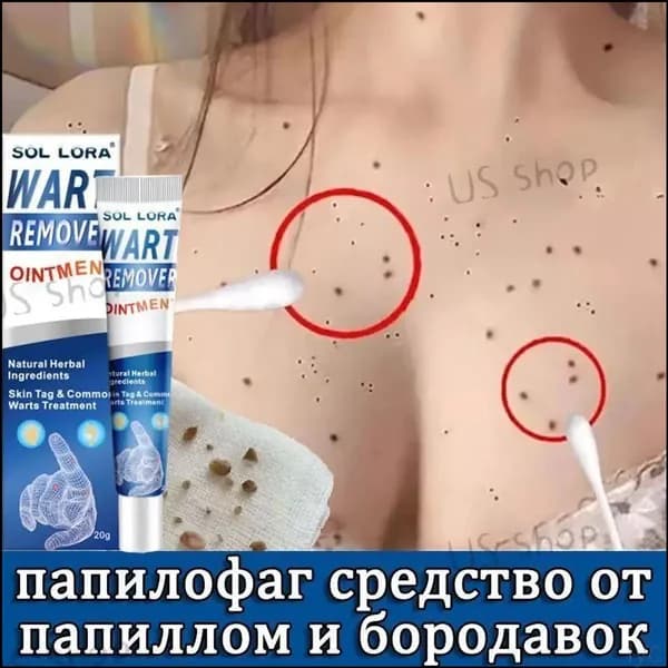 Эффективное средство против папиллом, кондилом, ороговевших участков кожи и бородавок, премиумпрепарат 20 г