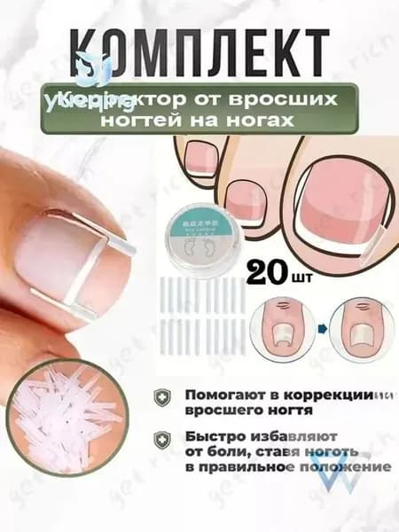 Корректор От Вросших Ногтей На Ногах1