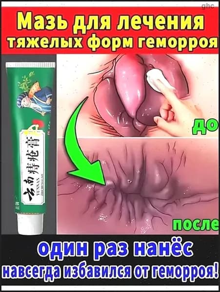 Китайская ЧУДО МАЗЬ от геморроя, 100% натуральная, не гормональная, крем от геморроя Чжи Чуан Гао 15 г