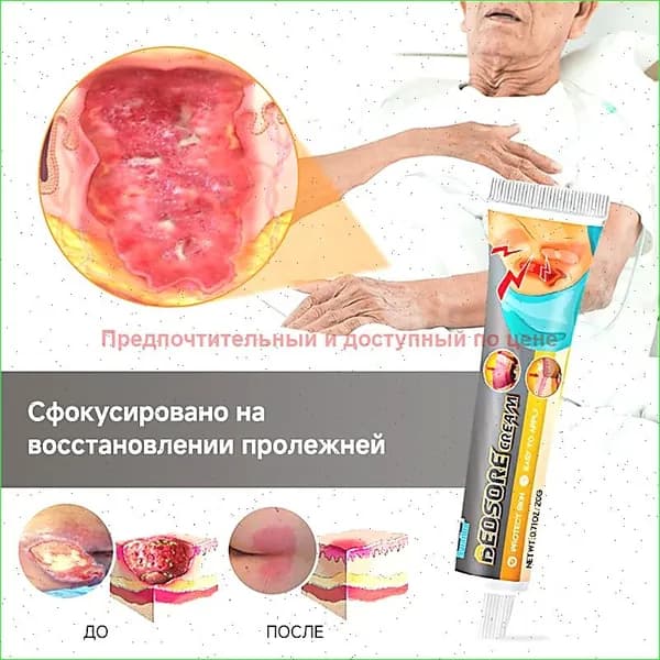 Заживляющая мазь от пролежней и ран, натуральный гель для лечения язв и ожогов, травяной крем 20 г