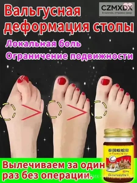 Легендарный тайский крем от косточки на ноге