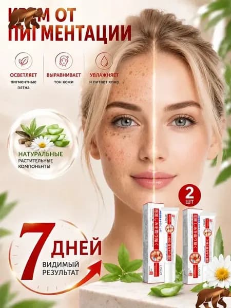Крем от пигментации для лица 2 шт., удаляет пигментные пятна, осветляющий крем против пигментации, выравнивает тон кожи, для мужчин и женщин, 20 г 2
