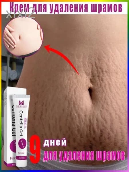 Средство от растяжек
