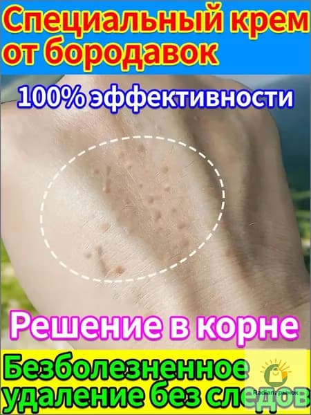 Безболезненное удаление плоских бородавок, папиллом, нитевидных и остроконечных кондилом без шрамов