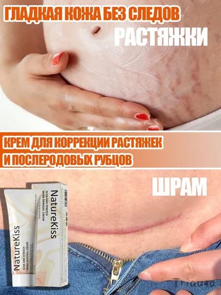 Крем от растяжек и рубцов для беременных NatureKiss 100 г крем от растяжек&Восстановление от рубцов