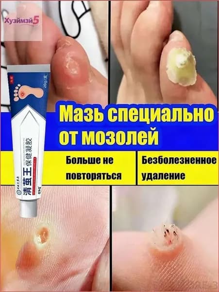 Mазь от мозолей стержневых и натоптышей ,Крем от сухих мозолей, шипицы, бородавок, натоптышей,20 г.