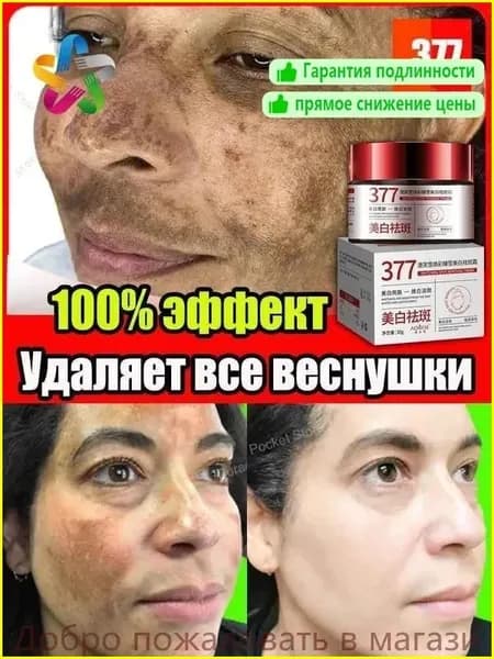 377 Отбеливающий крем от веснушек, пигментных пятен, 30 гр, эффективно борется со стойкими темными пятнами, осветляющий