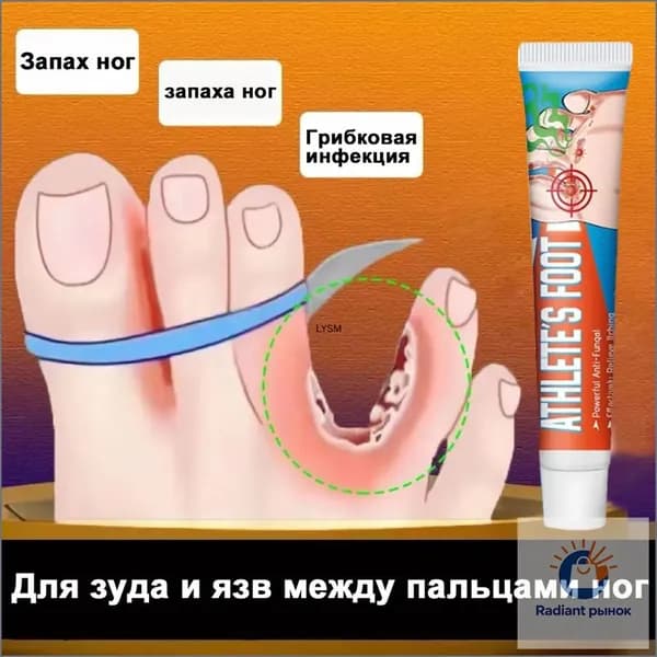 Средство от запаха ног для зуда и язв между пальцами, против грибка, дезодорант эффективное 20г