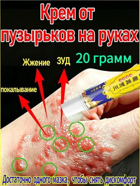 Травяная формула от стойкого герпеса на руках обладает антибактериальным и противозудным действием 20 г