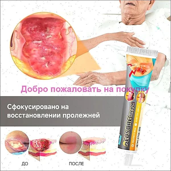 Заживляющая мазь от пролежней и ран, натуральный гель для лечения язв и ожогов, травяной крем 20 г
