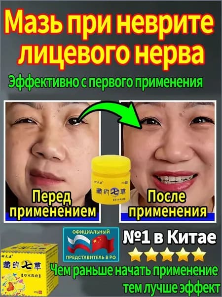 Средство от паралича лицевого нерва, растительные ингредиенты при неврите, перекошенном рте, гемифациальном спазме