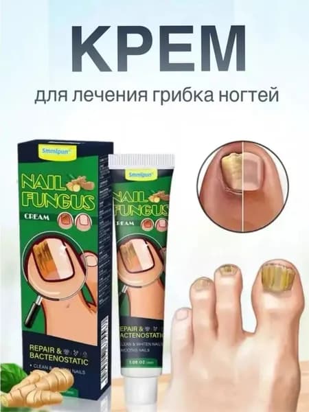 Мазь от грибка ногтей 30 г