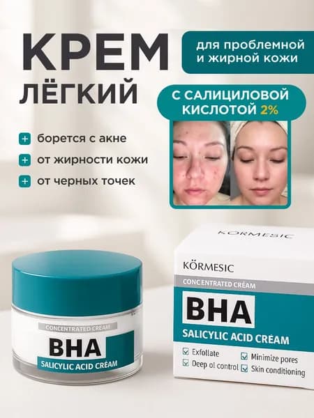 Увлажняющий крем для лица против акне и постакне / с салициловой кислотой и церамидами, по корейской технологии