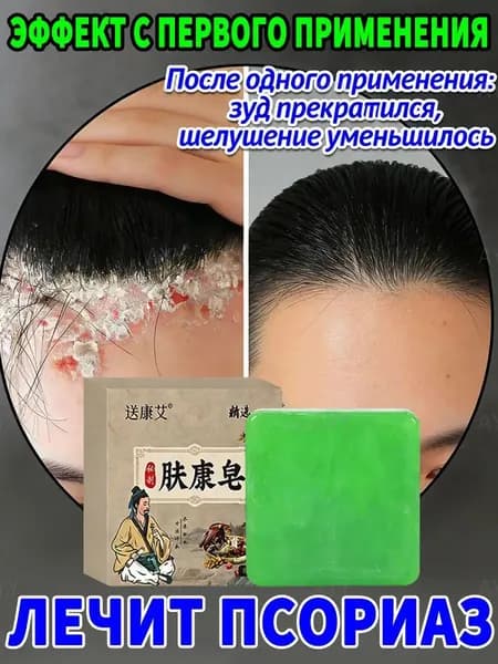 от себорейного дерматита лица и головы: избавление от перхоти за 7 дней